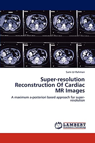 Super-resolution Reconstruction Of Cardiac MR Images: A maximum a-posteriori based approach for super-resolution