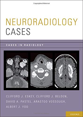 Neuroradiology Cases (Cases in Radiology)