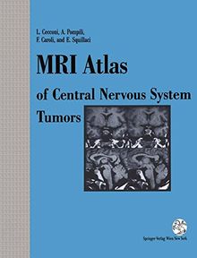 MRI Atlas of Central Nervous System Tumors