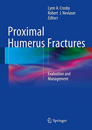 Proximal Humerus Fractures: Evaluation and Management