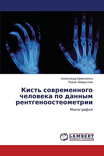 Kist' sovremennogo cheloveka po dannym rentgenoosteometrii: Monografiya: Monografiq