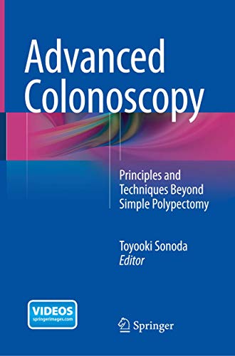 Advanced Colonoscopy: Principles and Techniques Beyond Simple Polypectomy
