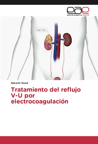 Tratamiento del reflujo V-U por electrocoagulación