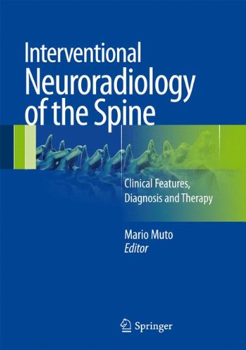 Interventional Neuroradiology of the Spine: Clinical Features, Diagnosis and Therapy
