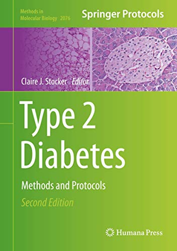 Type 2 Diabetes: Methods and Protocols (Methods in Molecular Biology, 2076, Band 2076)