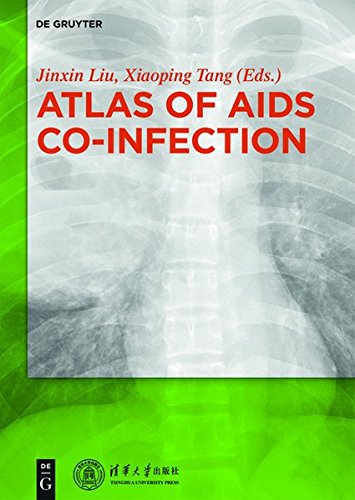 Atlas of AIDS Co-infection