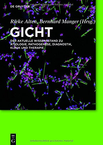 Gicht: Der aktuelle Wissensstand zu Ätiologie, Pathogenese, Diagnostik, Klinik und Therapie