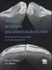 Adhäsiv befestigte Keramikrestaurationen: Biomimetische Sanierungen im Frontzahnbereich