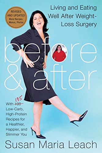 Before & After, Revised Edition: Living and Eating Well After Weight-Loss Surgery