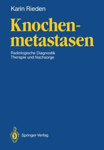 Knochenmetastasen: Radiologische Diagnostik, Therapie und Nachsorge