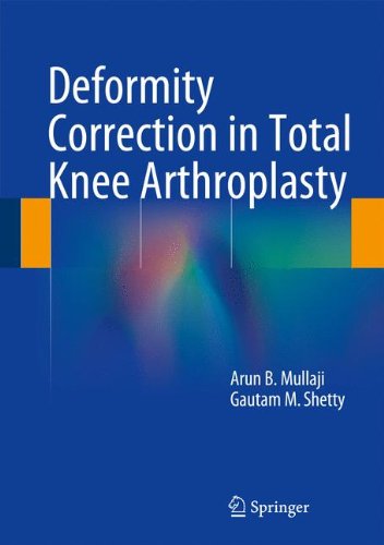 Deformity Correction in Total Knee Arthroplasty
