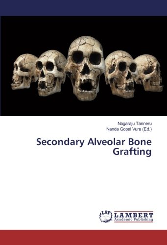 Secondary Alveolar Bone Grafting
