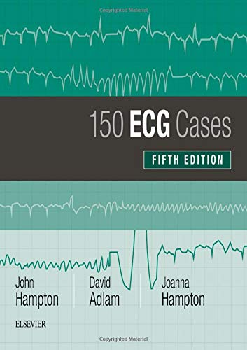 150 ECG Cases