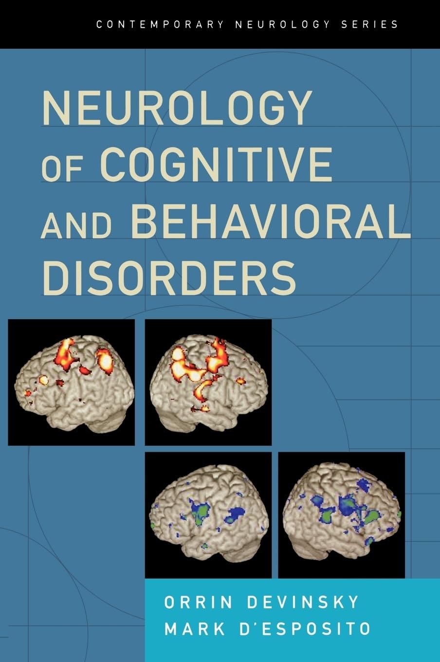 Neurology of Cognitive and Behavioral Disorders (Contemporary Neurology Series, Band 68)
