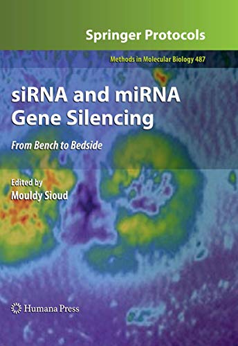 siRNA and miRNA Gene Silencing: From Bench to Bedside (Methods in Molecular Biology, Band 487)