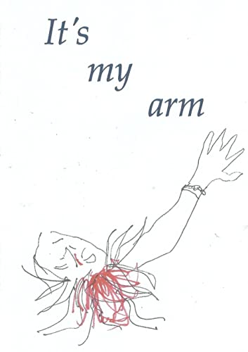 It's my arm