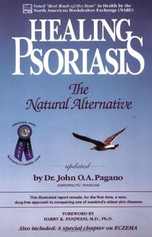 Healing Psoriasis: The Natural Alternative