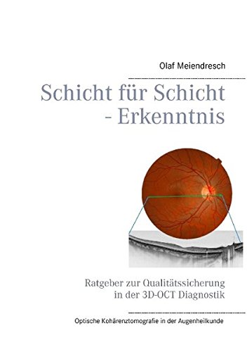 Schicht für Schicht - Erkenntnis: Ratgeber zur Qualitätssicherung in der 3D-OCT Diagnostik