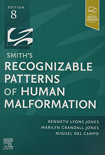 Jones Md, Kenneth Lyons Smith's Recognizable Patterns Of Human Malformation, Expert Consult - Online And Print