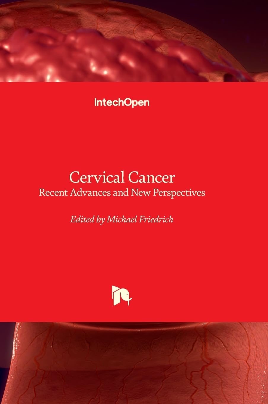 Cervical Cancer - Recent Advances and New Perspectives: Recent Advances and New Perspectives