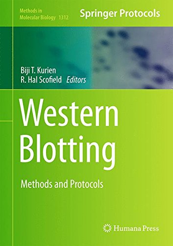Western Blotting: Methods and Protocols (Methods in Molecular Biology)