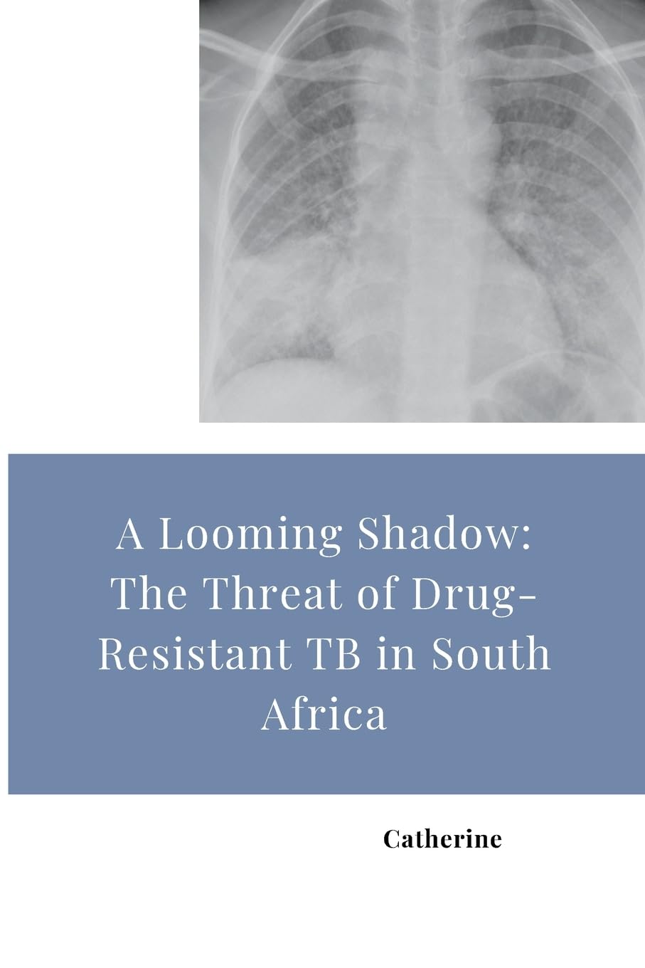 A Looming Shadow: The Threat of Drug-Resistant TB in South Africa: DE