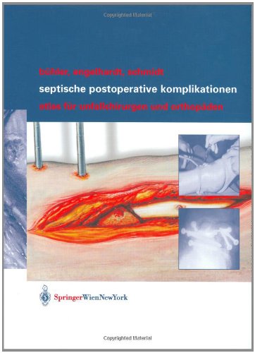 Septische postoperative Komplikationen: Atlas für Unfallchirurgen und Orthopäden