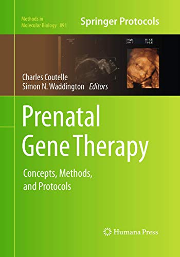 Prenatal Gene Therapy: Concepts, Methods, and Protocols (Methods in Molecular Biology, Band 891)