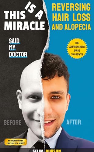 THIS IS A MIRACLE SAID MY DOCTOR: REVERSING HAIR LOSS AND ALOPECIA