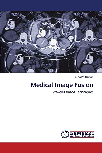Medical Image Fusion: Wavelet based Techniques