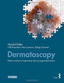 Dermatoscopy: An algorithmic method based on pattern analysis