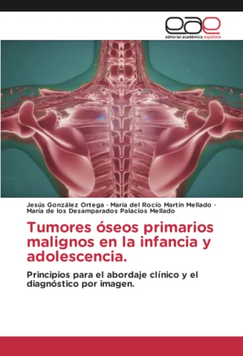 Tumores óseos primarios malignos en la infancia y adolescencia.: Principios para el abordaje clínico y el diagnóstico por imagen.