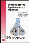 Erkrankungen von Hypothalamus und Hypophyse