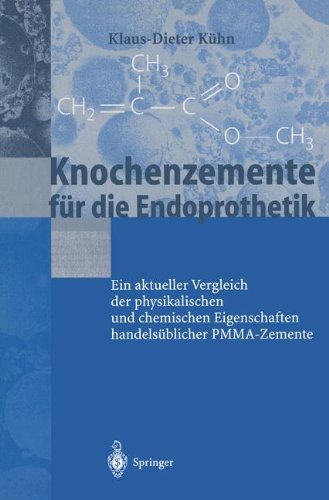 Knochenzemente für die Endoprothetik: Ein Aktueller Vergleich Der Physikalischen Und Chemischen Eigenschaften Handelsüblicher Pmma-Zemente