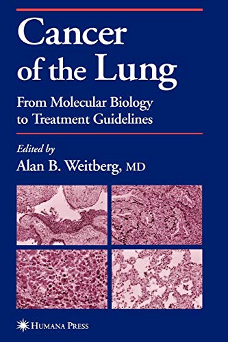 Cancer of the Lung: From Molecular Biology to Treatment Guidelines (Current Clinical Oncology)