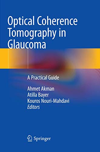 Optical Coherence Tomography in Glaucoma: A Practical Guide