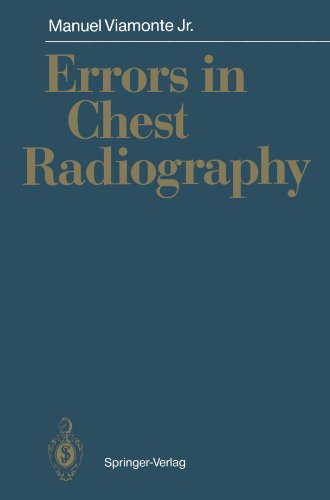 Errors in Chest Radiography