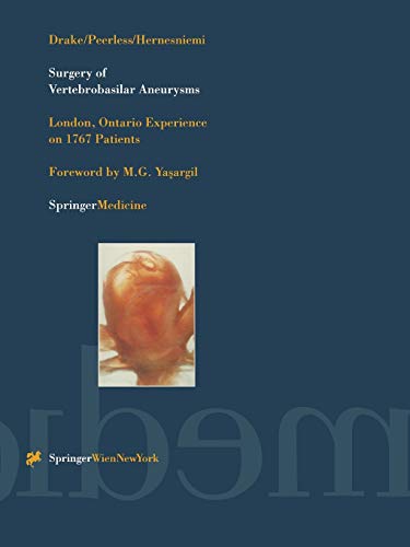 Surgery of Vertebrobasilar Aneurysms: London, Ontario Experience on 1767 Patients
