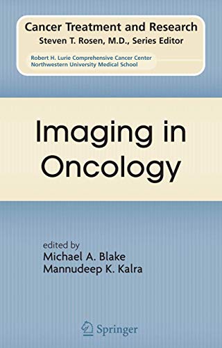 Imaging in Oncology (Cancer Treatment and Research, 143, Band 143)