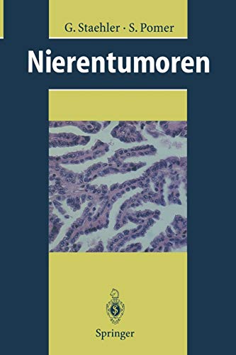 Nierentumoren: Grundlagen, Diagnostik, Therapie