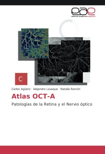 Atlas OCT-A: Patologías de la Retina y el Nervio óptico