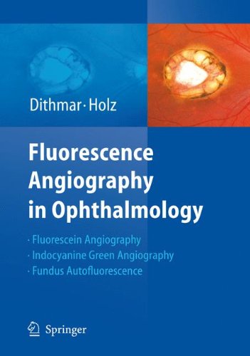 Fluorescence Angiography in Ophthalmology: Fluorescein Angiography, Indocyanine Green Angiography, Fundus Autofluorescence