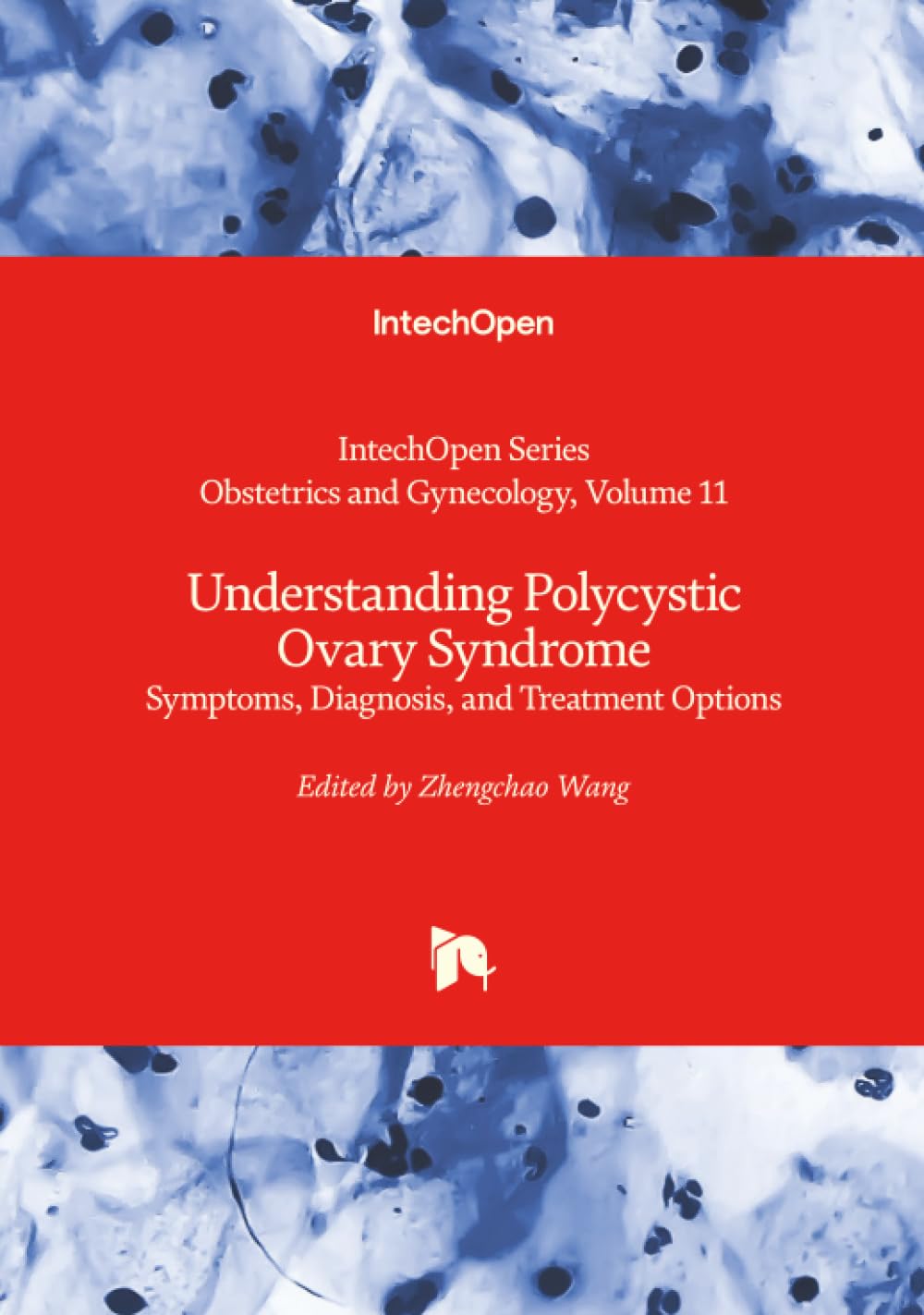 Understanding Polycystic Ovary Syndrome - Symptoms, Diagnosis, and Treatment Options (Obstetrics and Gynecology, Band 11)