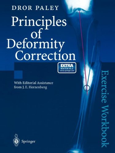 Principles of Deformity Correction: Exercise Workbook