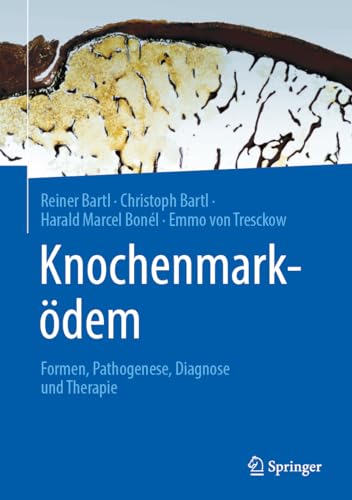 Knochenmarködem: Formen, Pathogenese, Diagnose und Therapie