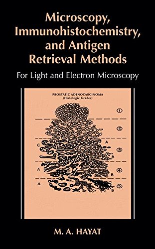 Microscopy, Immunohistochemistry, and Antigen Retrieval Methods: For Light and Electron Microscopy