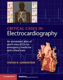 Critical Cases in Electrocardiography: An Annotated Atlas of Don't-Miss ECGs for Emergency Medicine and Critical Care