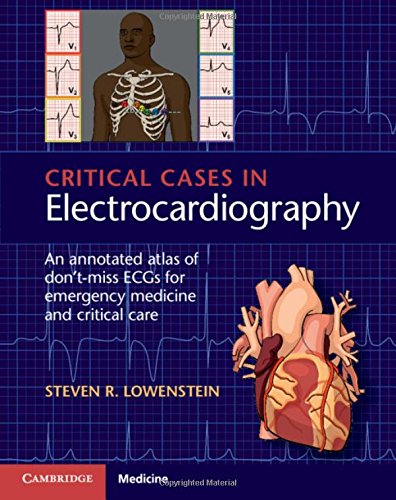 Critical Cases in Electrocardiography: An Annotated Atlas of Don't-Miss ECGs for Emergency Medicine and Critical Care