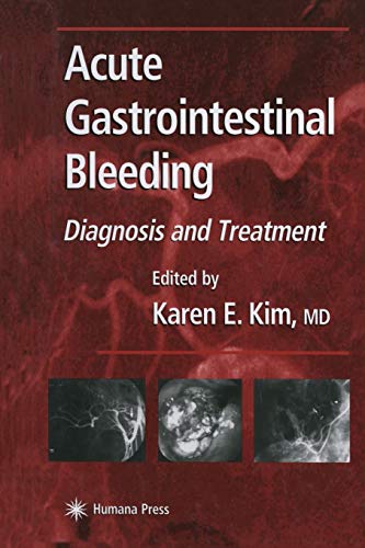 Acute Gastrointestinal Bleeding: Diagnosis and Treatment (Clinical Gastroenterology)