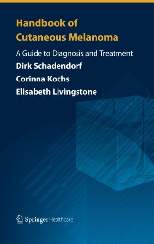 Handbook of Cutaneous Melanoma: A Guide to Diagnosis and Treatment